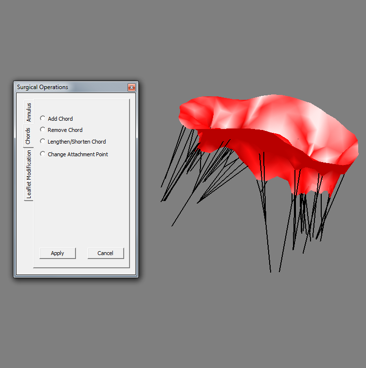 Mitral_valve_simulation